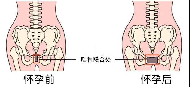 骨盆，产后恢复中心加盟