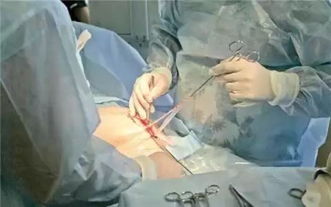 为什么孕妇顺产爸爸能在旁观看，而剖腹产就不行？
