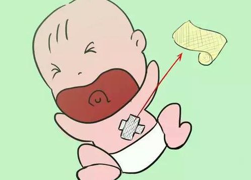 宝宝肚脐护理有方法 漂亮妈妈产后恢复中心
