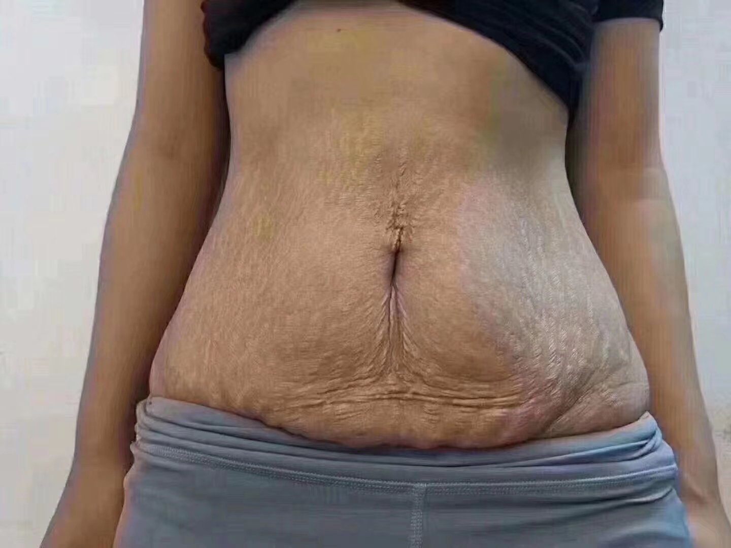 为什么同样生孩子，有些宝妈产后恢复得这么快？产后恢复中心哪家效果好？
