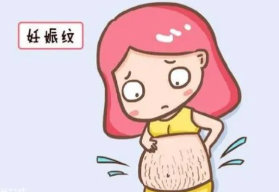 月子会所加盟，这6类妈妈最容易长纹