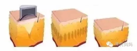 【漂亮妈妈科普篇】有一种瘦叫我是你的热立塑!