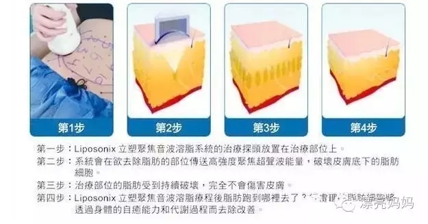 【漂亮妈妈科普篇】有一种瘦叫我是你的热立塑!