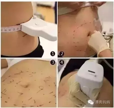 【漂亮妈妈科普篇】有一种瘦叫我是你的热立塑!