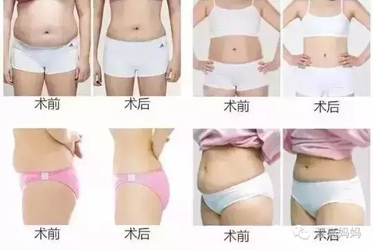 【漂亮妈妈科普篇】有一种瘦叫我是你的热立塑!